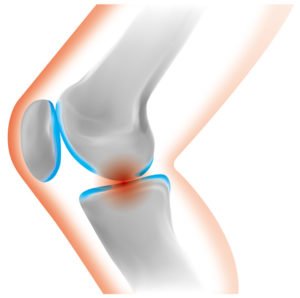 整体（骨盤矯正）凡座　膝関節の図